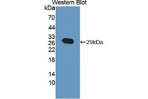 Western blot analysis of the recombinant protein. (ABCA12 antibody  (AA 1346-1577))