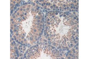 IHC-P analysis of testis tissue, with DAB staining. (CA13 antibody  (AA 1-262))