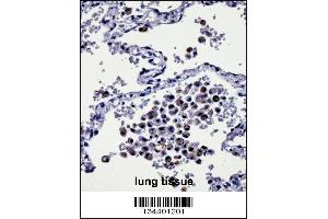 CYSLTR1 Antibody immunohistochemistry analysis in formalin fixed and paraffin embedded human lung tissue followed by peroxidase conjugation of the secondary antibody and DAB staining. (CysLTR1 antibody  (AA 144-172))