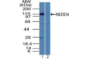 Image no. 1 for anti-Neural Precursor Cell Expressed, Developmentally Down-Regulated 4, E3 Ubiquitin Protein Ligase (NEDD4) (AA 200-250) antibody (ABIN960274) (NEDD4 antibody  (AA 200-250))