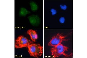 ABIN6391346 Immunofluorescence analysis of paraformaldehyde fixed U251 cells, permeabilized with 0. (Cyclin T1 antibody  (Internal Region))