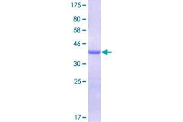 LGALS1/Galectin 1 Protein (AA 1-135) (GST tag)