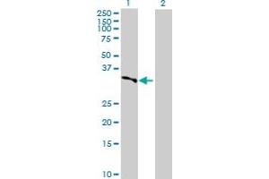 Lane 1: LYPLA1 transfected lysate ( 25. (LYPLA1 293T Cell Transient Overexpression Lysate(Denatured))