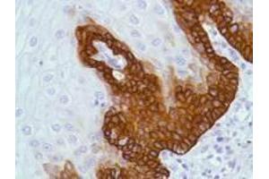 Immunohistochemistry (IHC) image for anti-BCL2-Associated X Protein (BAX) (Internal Region) antibody (ABIN6655295)