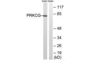 Western blot analysis of extracts from Rat brain cells, using PRKCG(Ab-655) antibody. (PKC gamma antibody  (Thr655))