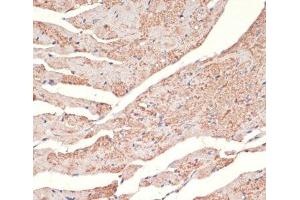 Immunohistochemistry of paraffin-embedded Mouse heart using ADRA1A Polyclonal Antibody at dilution of 1:100 (40x lens). (alpha 1 Adrenergic Receptor antibody)