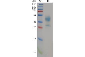 Human MDR-1 Protein, hFc Tag on SDS-PAGE under reducing condition. (Malic Enzyme Complex, Mitochondrial (Mod2) (AA 72-113) protein (Fc Tag))