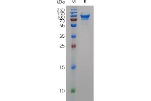 Mouse CD93 Protein, His Tag on SDS-PAGE under reducing condition. (CD93 Protein (CD93) (AA 23-572) (His tag))