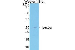 Western Blotting (WB) image for anti-Procollagen III N-Terminal Propeptide (PIIINP) (AA 34-272) antibody (Biotin) (ABIN1173224) (PIIINP antibody  (AA 34-272) (Biotin))