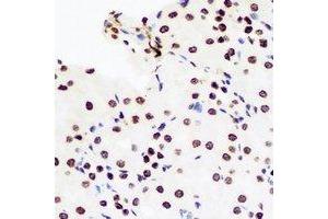 Immunohistochemical analysis of DCK staining in rat kidney formalin fixed paraffin embedded tissue section. (DCK antibody)