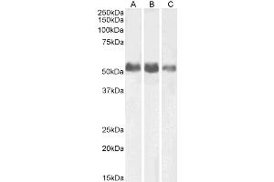 Image no. 1 for anti-Alkaline Phosphatase, Liver/bone/kidney (ALPL) (AA 42-53) antibody (ABIN5856333) (ALPL antibody  (AA 42-53))