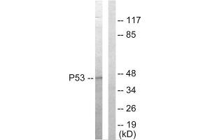 Western blot analysis of extracts from HepG2 cells, using p53 antibody. (p53 antibody  (C-Term))