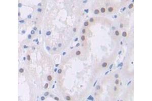 IHC-P analysis of Human Tissue, with DAB staining. (Polybromo 1 antibody  (AA 1152-1273))