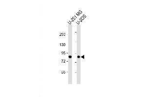 Western Blot at 1:1000 dilution Lane 1: U-2OS whole cell lysate Lane 2: U-251 MG whole cell lysate Lysates/proteins at 20 ug per lane. (GIT1 antibody  (AA 366-395))