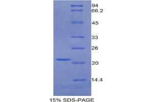 SDS-PAGE analysis of Mouse GAS6 Protein. (GAS6 Protein)