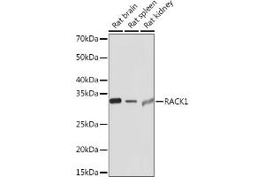 Western blot analysis of extracts of various cell lines, using R Rabbit mAb (ABIN1679360, ABIN3018118, ABIN3018119 and ABIN7101576) at 1:1000 dilution. (GNB2L1 antibody)