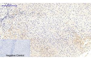 Immunohistochemical analysis of paraffin-embedded human liver tissue. (MEK1/2 Antikörper  (pSer218, pSer222))