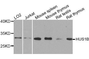 Western blot analysis of extracts of various cell lines, using HUS1B antibody. (HUS1B antibody  (AA 1-278))