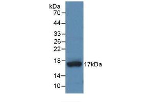 Detection of Recombinant ADAMTS4, Human using Monoclonal Antibody to A Disintegrin And Metalloproteinase With Thrombospondin 4 (ADAMTS4) (ADAMTS4 antibody  (AA 437-575))