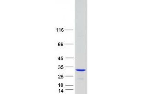 BCAP31 Protein (Transcript Variant 2) (Myc-DYKDDDDK Tag)