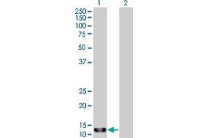 Western Blot analysis of STK10 expression in transfected 293T cell line by STK10 MaxPab polyclonal antibody. (STK10-A antibody  (AA 12-144))