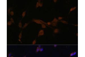 Immunofluorescence analysis of NIH/3T3 cells using ATG7 Polyclonal Antibody at dilution of 1:100. (ATG7 antibody)