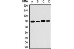 Western blot analysis of SH2B1 expression in HT29 (A), MCF7 (B), mouse kidney (C), mouse brain (D) whole cell lysates. (SH2B1 antibody)