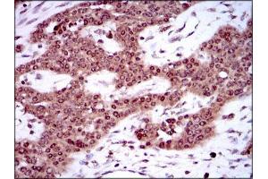 Immunohistochemistry (IHC) image for anti-Sex Determining Region Y (SRY) (AA 1-204) antibody (ABIN1098106)