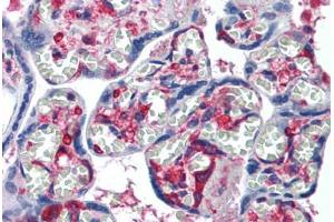 Human Placenta: Formalin-Fixed, Paraffin-Embedded (FFPE) (NME1 antibody  (AA 43-153))