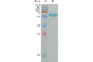Human I Protein, hFc Tag on SDS-PAGE under reducing condition. (IGSF11 Protein (AA 23-241) (Fc Tag))