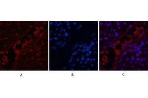 Immunofluorescence analysis of human appendix tissue. (NF-kB p65 antibody  (acLys310))