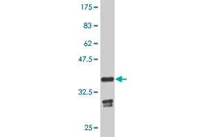 Western Blot detection against Immunogen (35. (GBX2 antibody  (AA 141-230))