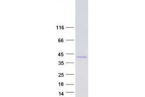 Validation with Western Blot (AKR1B1 Protein (Myc-DYKDDDDK Tag))