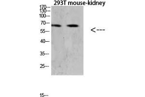 Western blot analysis of Hela lysate, antibody was diluted at 1:1000. (TNFRSF11A antibody  (AA 60-120))