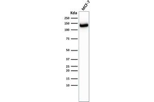 Western Blot Analysis of MCF-7 cells using E-Cadherin Rabbit Recombinant Monoclonal Antibody (CDH1/2208R). (Recombinant E-cadherin antibody)