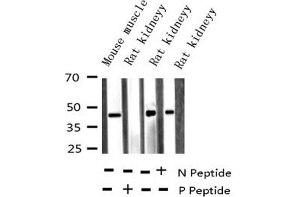 HNRNPC antibody  (pSer260)