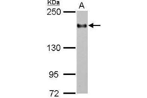 WB Image Sample (30 ug of whole cell lysate) A: THP-1 5% SDS PAGE antibody diluted at 1:2000 (ITGAL antibody  (Internal Region))