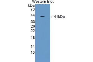 Figure. (S100A10 antibody  (AA 2-97))