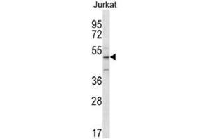 ABI2 Antibody (N-term) western blot analysis in Jurkat cell line lysates (35 µg/lane). (ABI2 antibody  (N-Term))