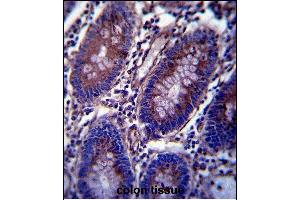 Vimentin Antibody (C-term) (ABIN389212 and ABIN2839367) immunohistochemistry analysis in formalin fixed and paraffin embedded human colon tissue followed by peroxidase conjugation of the secondary antibody and DAB staining. (Vimentin antibody  (C-Term))