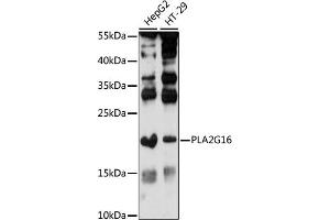 Western blot analysis of extracts of various cell lines, using PLG16 antibody (ABIN7267786) at 1:1000 dilution. (PLA2G16 antibody  (AA 68-162))