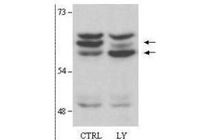 Western Blot of Rabbit anti-AKT2 antibody. (AKT2 antibody  (AA 455-468))