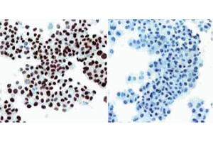 Immunohistochemical staining of SV40 large T, small t antigen. (SV40 Large T and Small Ts antibody (Biotin))