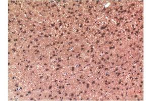 Immunohistochemical analysis of paraffin-embedded Rat Brain Tissue using Tau Mouse mAb diluted at 1:200. (tau antibody)