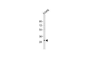 Anti-KLK6 Antibody (A13)at 1:2000 dilution + human lung lysates Lysates/proteins at 20 μg per lane. (Kallikrein 6 antibody  (N-Term))