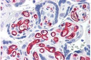 Human Placenta (formalin-fixed, paraffin-embedded) stained with CD34 antibody ABIN337371 at 10 ug/ml followed by biotinylated anti-mouse IgG secondary antibody ABIN481714, alkaline phosphatase-streptavidin and chromogen. (CD34 antibody)