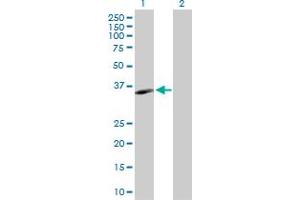 Western Blot analysis of MS4A1 expression in transfected 293T cell line by MS4A1 MaxPab polyclonal antibody. (CD20 antibody  (AA 1-297))