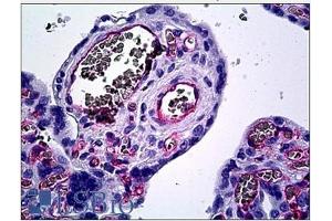 Immunohistochemistry (IHC) image for anti-Endothelium antibody (ABIN1107095) (Endothelium antibody)