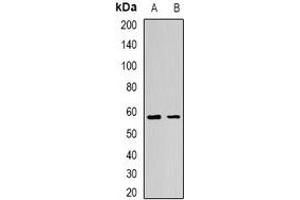 Western blot analysis of AdipoR1 expression in BT474 (A), mouse skeletal muscle (B) whole cell lysates. (Adiponectin Receptor 1 antibody)