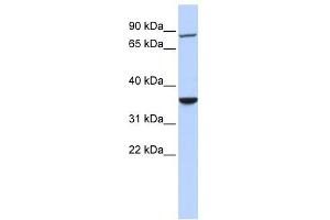 RNF207 antibody used at 1 ug/ml to detect target protein. (RNF207 antibody  (N-Term))